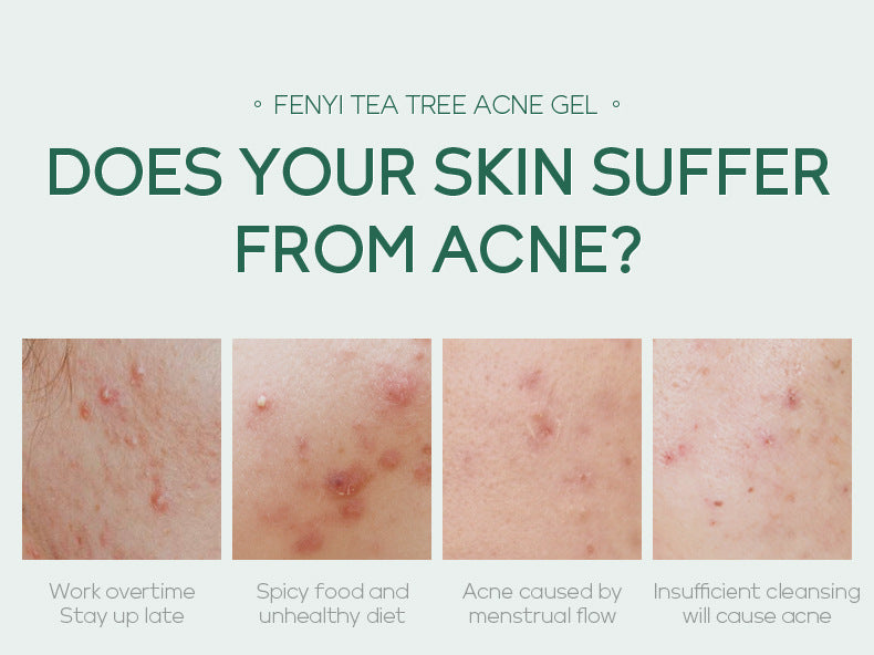 Tea Tree Acne Repair Gel – 20g Soothing & Moisturizing Skin Care Treatment